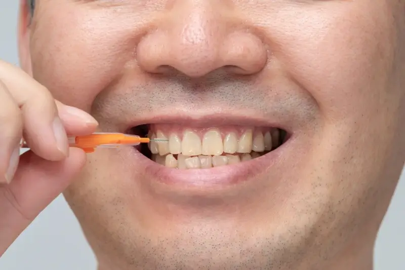 Najlepszy dentysta Warszawa